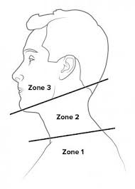 facial zones