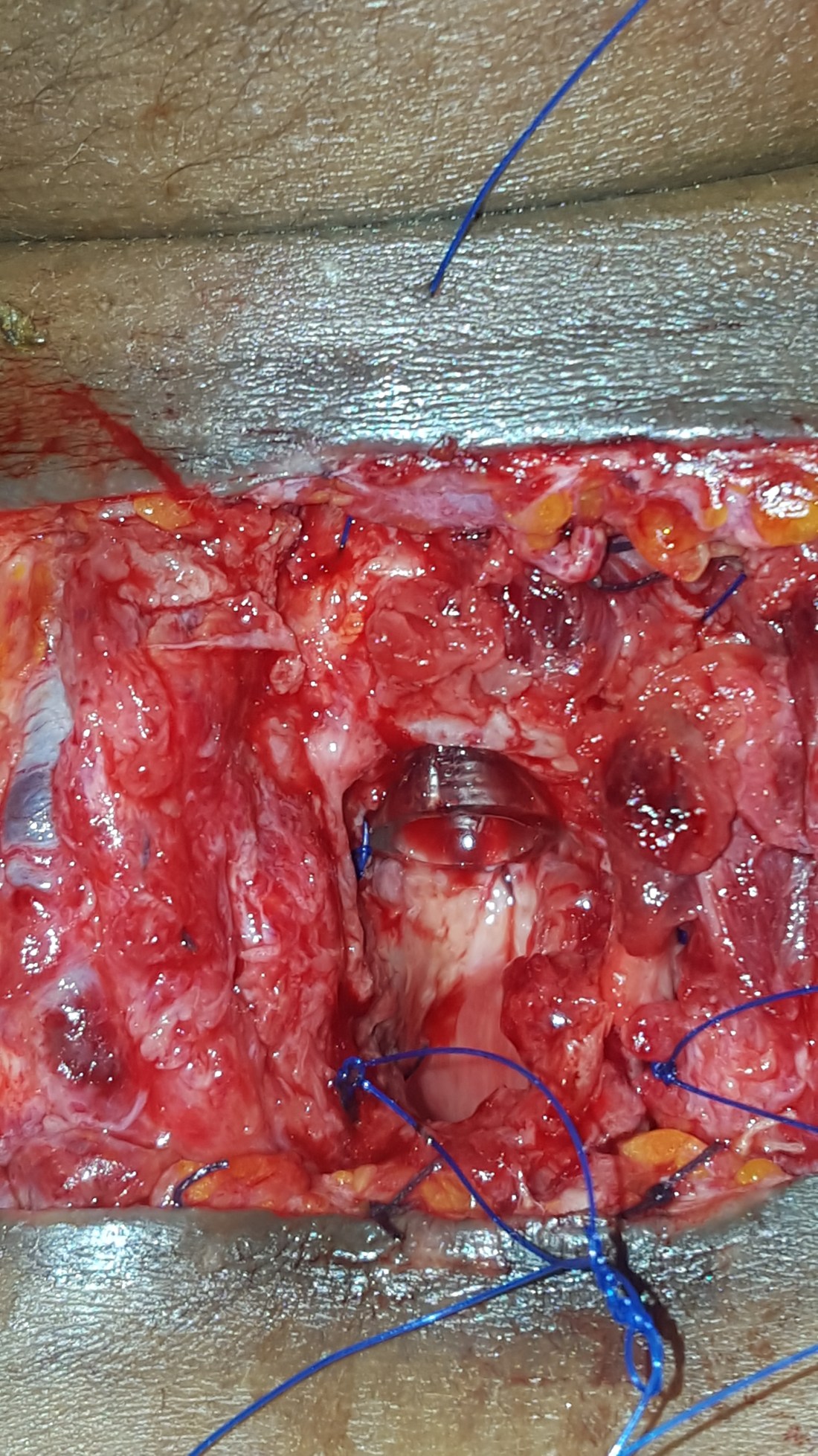 IMG_20190213_111514_515